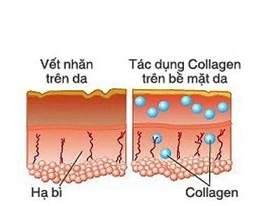 Collagen +C